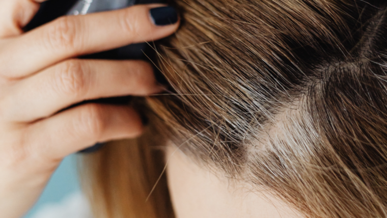 African American Dermatologist Specializing in Scalp and Hair Thinning Near Alexandria, Virginia